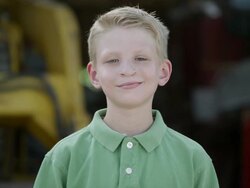 Slow motion push of boy smiling with cleft lip. Stock Footage