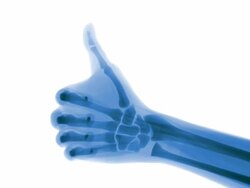 Blue X-ray thumbs up Stock Footage