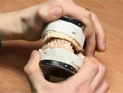 Dentistry Stock Footage