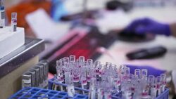 Cheking analyses number on  tubes in medical laboratory Stock Footage