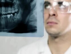 Dentist examining X-Ray image Stock Footage