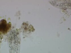 Ciliates moving around, bright field illumination Stock Footage