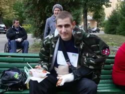 Injured Ukrainian soldiers at Military Hospital Stock Footage