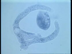 CU microscopic view of Amoeba engulfing prey Stock Footage