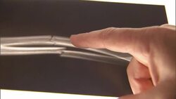 ECU, Man's hand pointing on X-ray image of fractured human bone Stock Footage