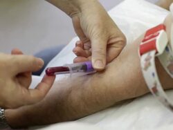 Taking blood from filmmakers arm, UK Stock Footage