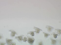 Vorticella sp. -though often found in clusters, each stalk is individually attached to the surface. Stock Footage