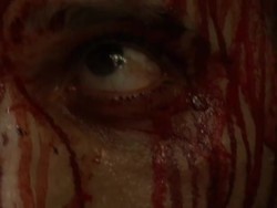 Injured People in Dar Al Shifa Hospital, Aleppo News Clip