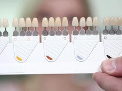 Choose white of teeth Stock Footage