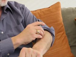 Glucose Monitoring Close Up - D Stock Footage