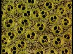 Microscopic cross sectional view through woody stems to show vascular bundles, xylem, cambium, phloem Stock Footage