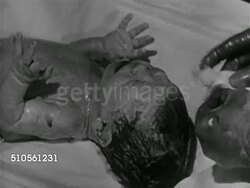 1965: NEWBORN BABY: MS Crying newborn being held by doctor, BEHIND MOTHER Newborn baby being lifted by doctor (umbilical cord still attached), MS Nurse cleaning crying baby w/ gauze, doctor measuring cranium, baby being handed to mother in bed. Instructional Video