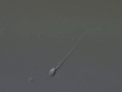 Single Human sperm swimming, Interference contrast Stock Footage