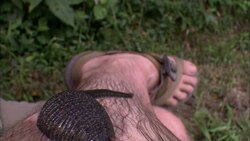 A leech slithers over a man's leg. Stock Footage