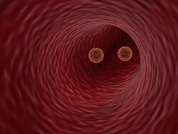 Virus infection Stock Footage
