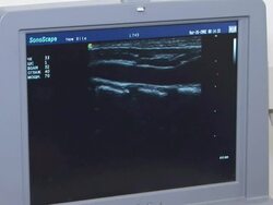 medical equipment Stock Footage