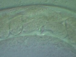 Caenorhabditis elegans wild type containing eggs, also the vulva is visible. Olympus BH-2 microscope, 60x S-Plan Apochromat objective, NFK .67 photoeyepiece, Differential Interference Contrast, horizontal field of view 200 microns. Stock Footage