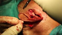 Face Joint dental option Stock Footage