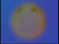 Microscopic view of Volvox, pull focus Stock Footage