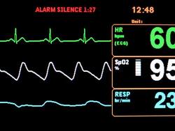 Vital signs monitor Stock Footage