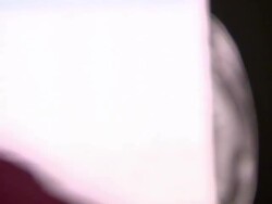 Doctors Looking Over MRI Scan On Computer News Clip