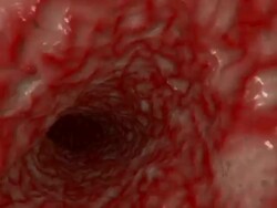 artery tunnel Stock Footage