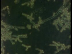 Candida albicans, live Thrush fungus, time lapse fungal hyphae growing Stock Footage