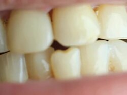Human teeth Stock Footage