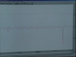 Lying is being detected in brain waves News Clip