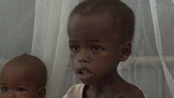 CLEAN: Malnutrition ravaging Somalia, children hardest hi News Clip