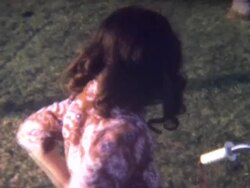 Chicken Pox 1960's Stock Footage