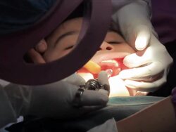 Little Girl At Dentist. Stock Footage