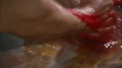 Hands wash blood from arms in a basin of water. Stock Footage
