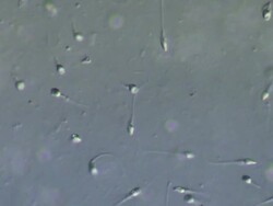 Human sperm, medium close up lots sperm swimming around. Interference contrast. Stock Footage