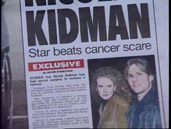 UK: NICOLE KIDMAN REPORTED TO HAVE HAD SURGERY TO REMOVE A CYST Instructional Video