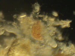 Microorganism Stock Footage