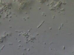 Friendly bacteria, Lactobacillus casei. A rod-shaped gram-positive, non-sporing, non-motile, obligate anaerobe, which inhabits human intestinal tracts. It is beneficial to human health eg improves and promotes digestion. Stock Footage