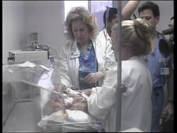 MEXICO: TIJUANA: DOCTORS PREPARE TO SEPARATE SIAMESE TWINS News Clip