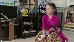 VOICED : Nioos superheroes en Colombia gracias a protesis impresas en 3D News Clip