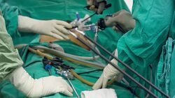 HD DOLLY : Endoscopic surgery Stock Footage