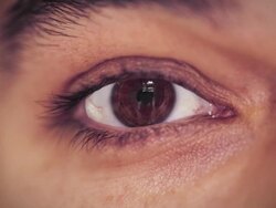 Eye globe Stock Footage