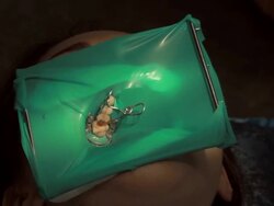 Dentist and assistant making dental filling Stock Footage