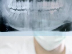 Dentist examining X-Ray image Stock Footage
