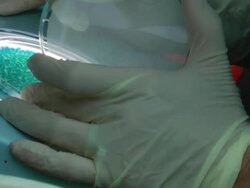 Blue bacteriophage plaques Stock Footage