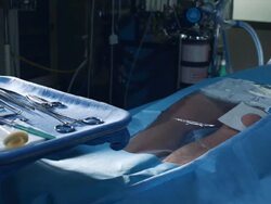 CU Patient in operating room / Edmonds, Washington, USA Stock Footage