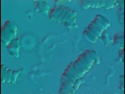 Protozoa (Trypanosoma brucei) in mouse blood - attacking blood cells, parasite in vertebrates Stock Footage