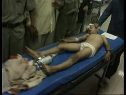 Turkey - Bazaar blast aftermath News Clip