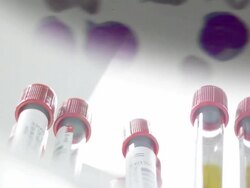 medical and laboratory design Stock Footage