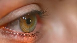 ECU Flashlight test being done on the eye Stock Footage