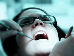Young Woman at dentist, dental procedure, working on teeth (HD720p) Stock Footage